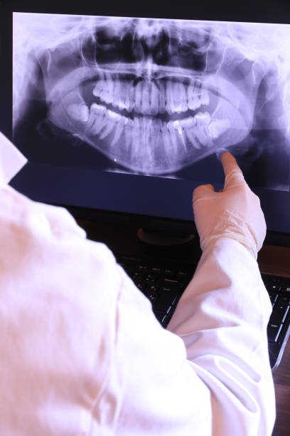 Best Broken or Chipped Tooth Repair in Warren, MI